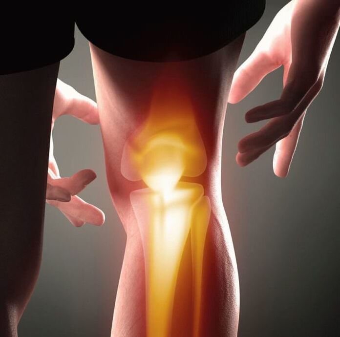 Qu'est-ce que l'arthrite et l'arthrose
